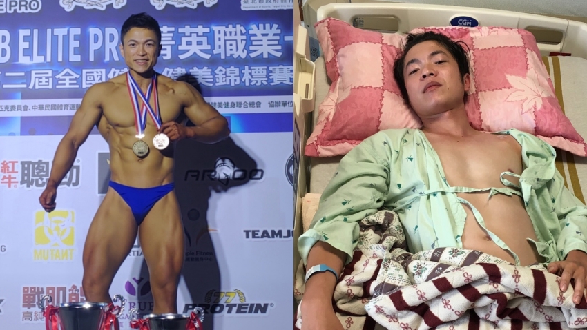 淋巴癌 健美冠軍 黃昱清