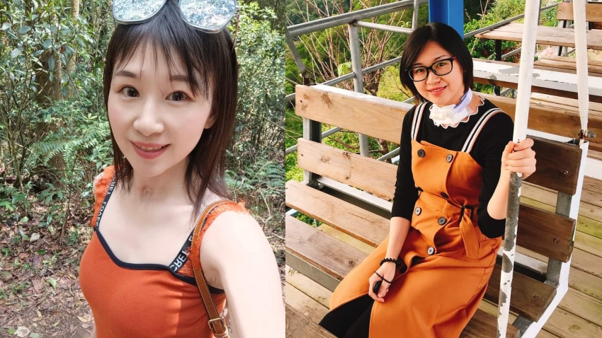甲狀腺癌 郭向晶 晶晶兒