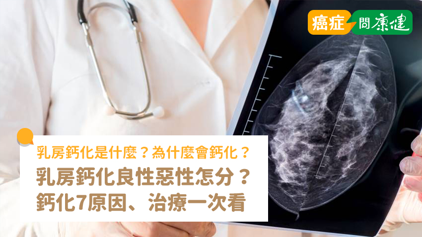 乳房鈣化是什麼？鈣化良性惡性怎麼分？鈣化7原因、治療一次看