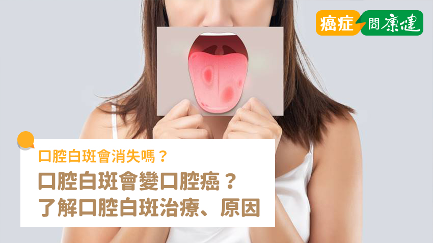 口腔白斑會消失嗎？變口腔癌？了解口腔白斑治療、原因