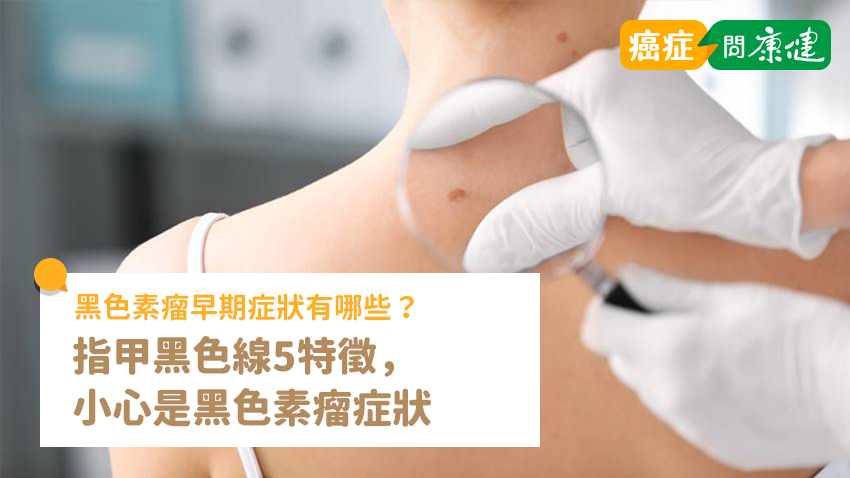 黑色素瘤早期症狀？指甲黑色線5特徵小心是黑色素瘤症狀