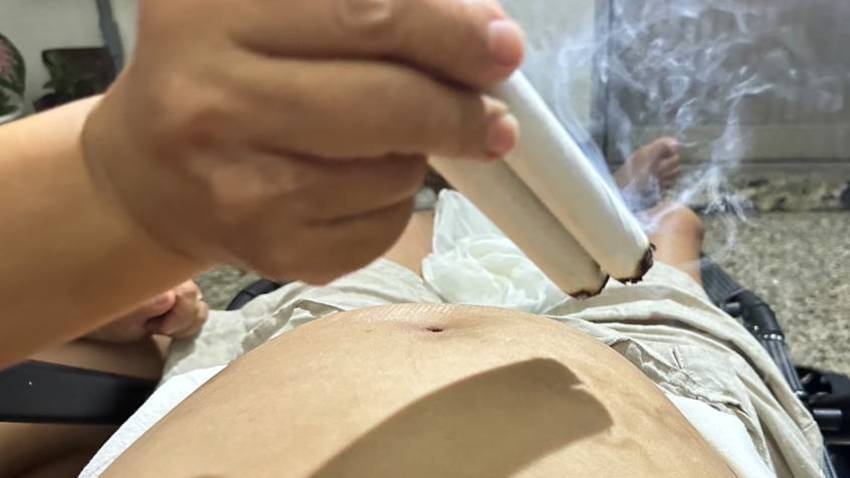 癌患腹水、腹脹、吃不下暴瘦 18 公斤，中醫「溫灸」讓他消水腫，重回正常生活