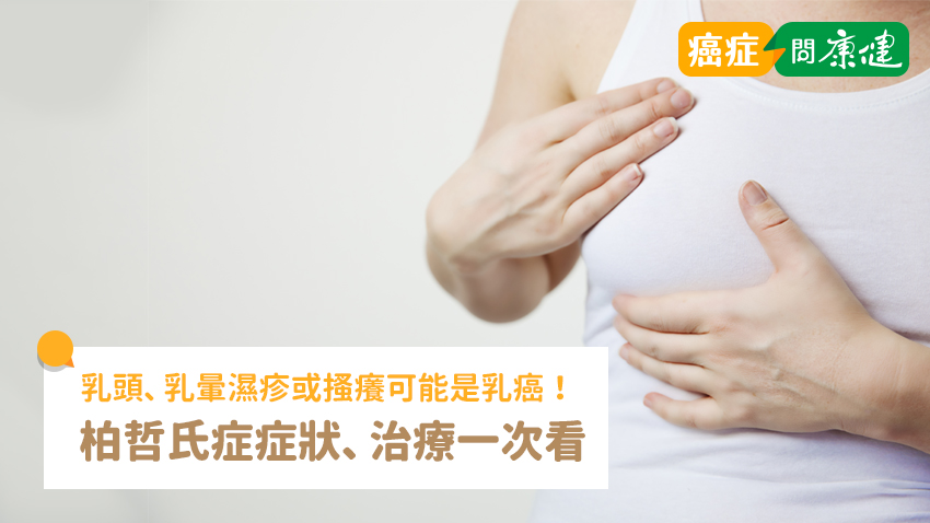 單側乳頭、乳暈濕疹或搔癢，可能是乳癌！柏哲氏症症狀、治療一次看