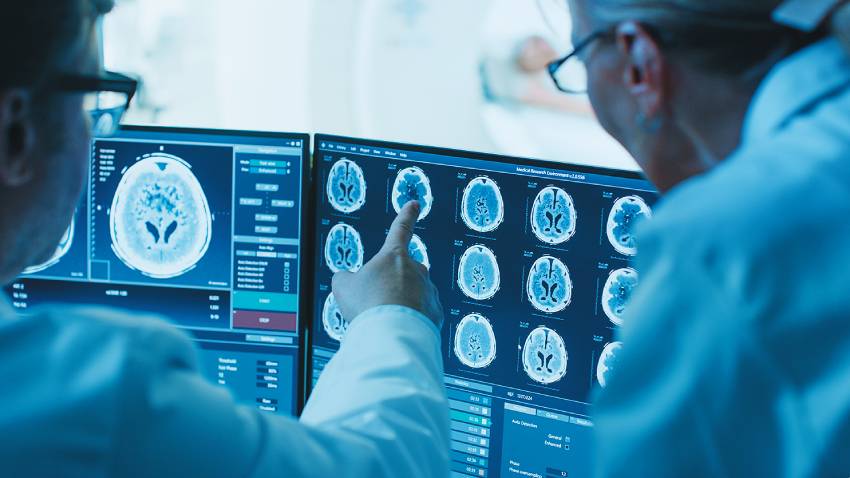 台灣第一個DeepMets AI 輔助腦瘤門診， 縮短病人一個月等待煎熬
