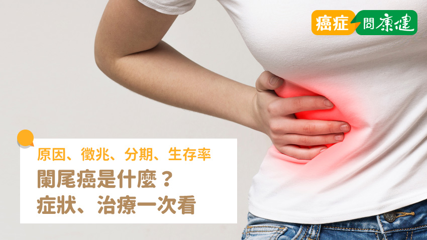 闌尾癌是什麼？原因、徵兆、分期、治療、生存率一次看