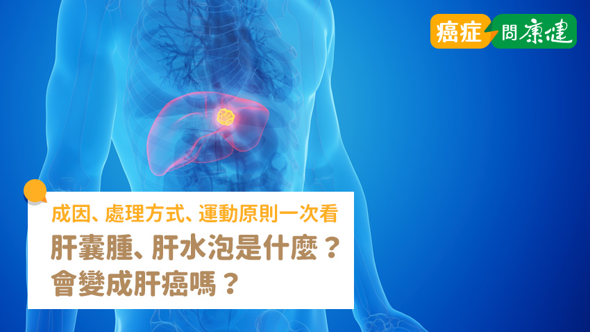 肝水泡是什麼？會變成肝癌嗎？肝囊腫成因、處理方式、運動原則一次看