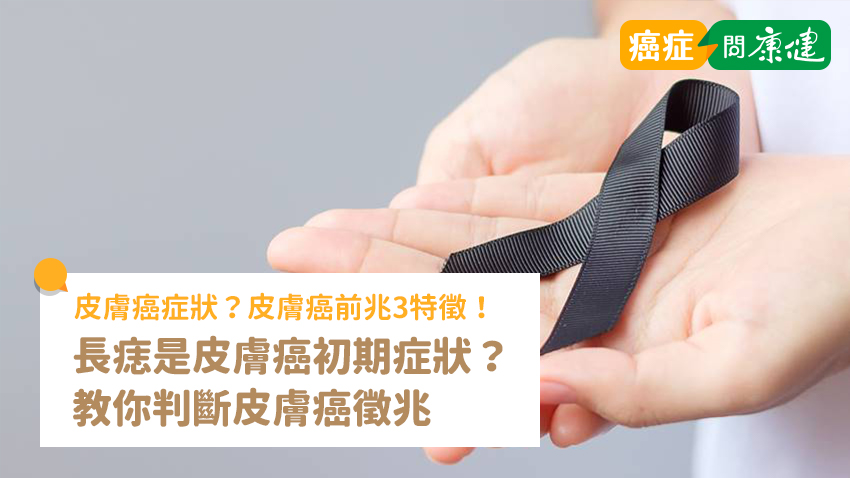 皮膚癌前兆3特徵！長痣是皮膚癌初期症狀？教判斷皮膚癌徵兆