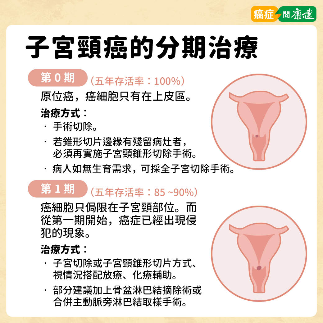 子宮頸癌第0期、子宮頸癌第1期治療方法與存活率