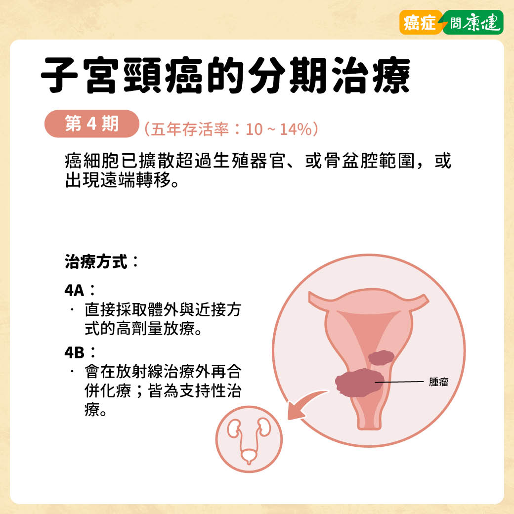 子宮頸癌第4期治療方法與存活率