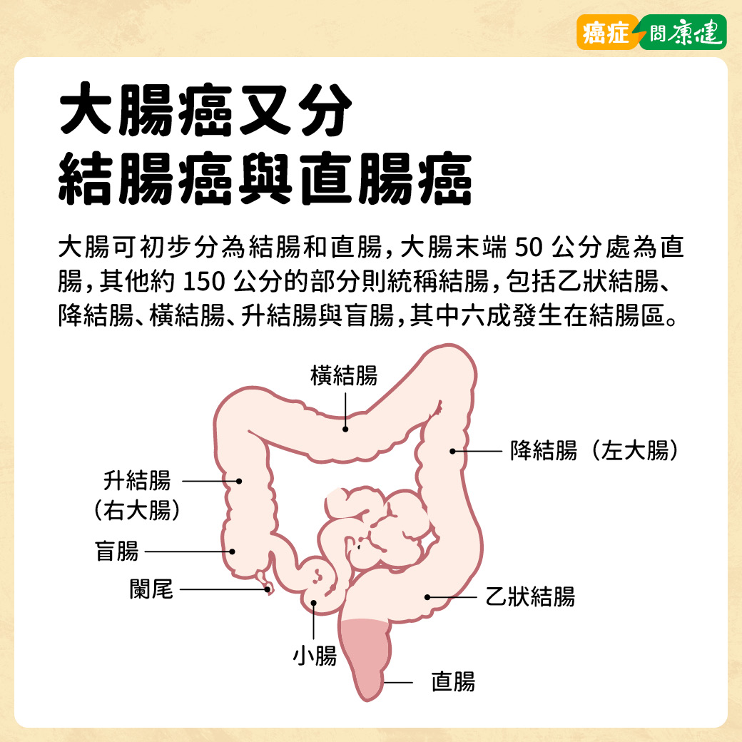 大腸癌又分結腸癌與直腸癌